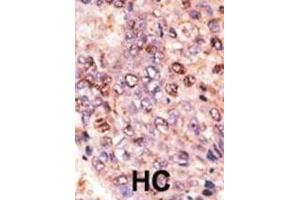 Immunohistochemistry (IHC) image for anti-ATP-Binding Cassette, Sub-Family B (MDR/TAP), Member 7 (ABCB7) antibody (ABIN3002511) (ABCB7 antibody)