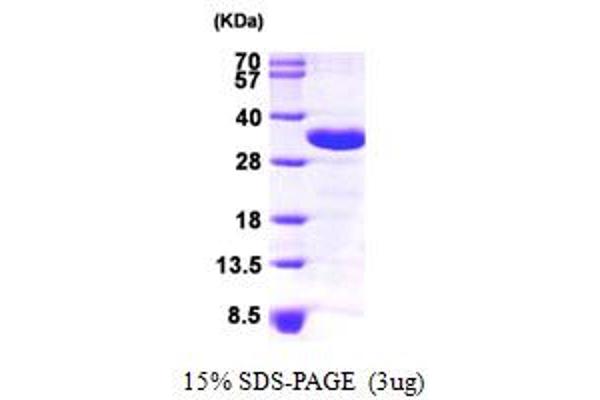 CHMP2A Protein (AA 1-222) (His tag)