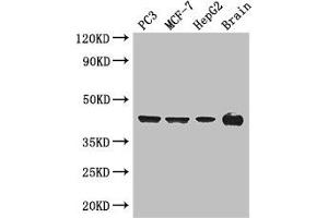 Western Blot Positive WB detected in: PC-3 whole cell lysate, MCF-7 whole cell lysate, HepG2 whole cell lysate, Mouse brain tissue All lanes: AMACR antibody at 3 μg/mL Secondary Goat polyclonal to rabbit IgG at 1/50000 dilution Predicted band size: 43, 26, 23, 44 kDa Observed band size: 43 kDa (AMACR antibody  (AA 13-175))