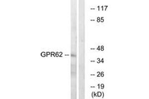 Western Blotting (WB) image for anti-G Protein-Coupled Receptor 62 (GPR62) (AA 181-230) antibody (ABIN2890876) (GPR62 antibody  (AA 181-230))