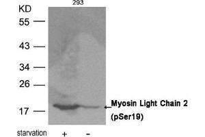 Western blot analysis of extracts from 293 cells untreated or treated with starvation using Myosin Light Chain 2 (Phospho-Ser19) Antibody. (MYL9 antibody  (pSer19))