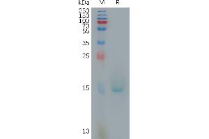 Human IL10 Protein, His Tag on SDS-PAGE under reducing condition. (IL-10 Protein (AA 19-178) (His tag))