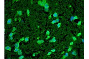 Hsp22 Immunofluorescence. (HSPB8 antibody)