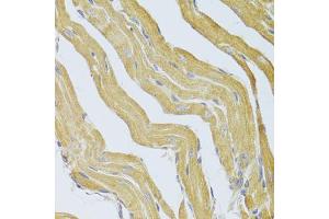 Immunohistochemistry of paraffin-embedded mouse heart using PPP2R1B Antibody (ABIN5974048) at dilution of 1/100 (40x lens). (PPP2R1B antibody)