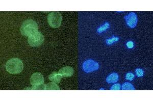 Immunocytochemistry staining of alpha-tubulin in K562 cells using purified rat monoclonal antibody YOL1/34 (concentration in sample 6 μg/mL, DAR FITC, left picture) vs. (alpha Tubulin antibody)