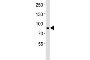 Western blot analysis of lysate from NCI-H1299 cell line using MMP9 antibody at 1:1000. (MMP 9 antibody  (AA 644-673))