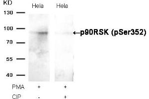 Western blot analysis of extracts from Hela cells, treated with PMA or calf intestinal phosphatase (CIP), using p90RSK (Phospho-Ser352) Antibody. (RPS6KA1 antibody  (pSer352))