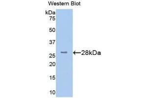 Western blot analysis of the recombinant protein. (STING/TMEM173 antibody  (AA 159-373))