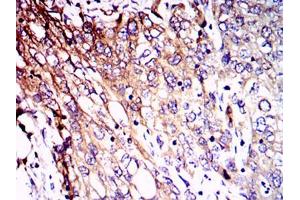 Immunohistochemistry (IHC) image for anti-Neurofilament, Light Polypeptide (NEFL) antibody (ABIN969548)