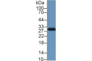 Western blot analysis of Pig Adrenal gland lysate, using Human STAR Antibody (1 µg/ml) and HRP-conjugated Goat Anti-Rabbit antibody ( (STAR antibody  (AA 1-285))