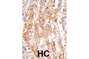 Immunohistochemistry (IHC) image for anti-Mitogen-Activated Protein Kinase Kinase Kinase 6 (MAP3K6) antibody (ABIN3003570) (MAP3K6 antibody)