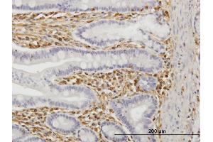 Immunoperoxidase of monoclonal antibody to TRIM16 on formalin-fixed paraffin-embedded human small Intestine. (TRIM16 antibody  (AA 165-273))