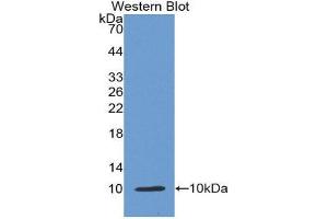 Western Blotting (WB) image for anti-Insulin (INS) (AA 25-110) antibody (ABIN1868717) (Insulin antibody  (AA 25-110))