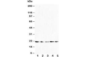 Western blot testing of FGF10 antibody and Lane 1:  U87;  2: HeLa;  3: A549;  4: 293T;  5: HeLa cell lysate (FGF10 antibody  (N-Term))