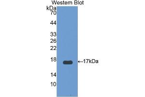 Western Blotting (WB) image for anti-Uncoupling Protein 2 (Mitochondrial, Proton Carrier) (UCP2) (AA 154-289) antibody (ABIN1175758) (UCP2 antibody  (AA 154-289))