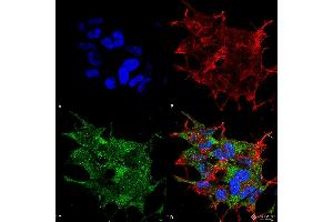 Immunocytochemistry/Immunofluorescence analysis using Rabbit Anti-Beclin 1 Polyclonal Antibody . (Beclin 1 antibody  (C-Term) (FITC))