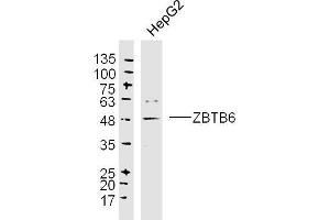 HepG2 lysates probed with ZBTB6 Polyclonal Antibody, Unconjugated  at 1:300 dilution and 4˚C overnight incubation. (ZBTB6 antibody  (AA 351-424))