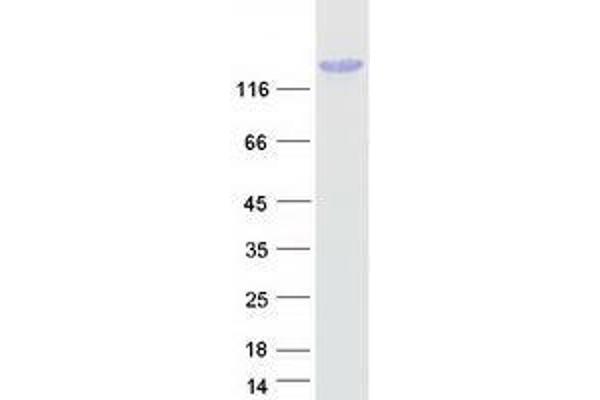 TCOF1 Protein (Transcript Variant 3) (Myc-DYKDDDDK Tag)