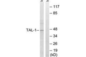 Western Blotting (WB) image for anti-T-Cell Acute Lymphocytic Leukemia 1 (TAL1) (AA 96-145) antibody (ABIN2889161) (TAL1 antibody  (AA 96-145))
