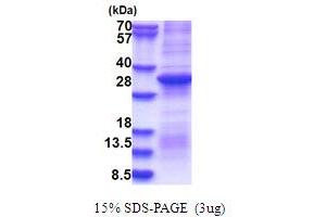 SDS-PAGE (SDS) image for Coagulation Factor II (thrombin) (F2) (AA 328-622) protein (ABIN5853681) (Prothrombin Protein (AA 328-622))