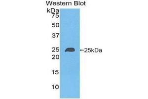 Western Blotting (WB) image for anti-Non Metastatic Cells 6, Protein Expressed In (AA 3-182) antibody (ABIN1860011) (Non Metastatic Cells 6, Protein Expressed In (AA 3-182) antibody)