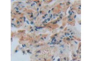 IHC-P analysis of Human Tissue, with DAB staining. (DKK4 antibody  (AA 107-212))