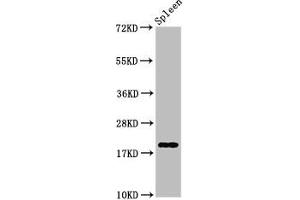 Western Blot Positive WB detected in: Rat spleen tissue All lanes: H1F0 antibody at 0. (Histone H1-Like (LOC107807853) antibody)