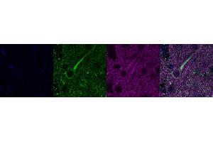 Immunohistochemistry (IHC) image for anti-Microtubule-Associated Protein 2 (MAP2) antibody (ABIN7455981) (MAP2 antibody)