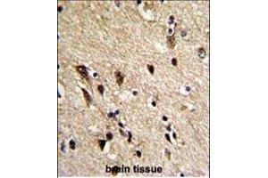 Paraformaldehyde-fixed, paraffin embedded Human Brain tissue, Antigen retrieval by boiling in sodium citrate buffer (pH6. (TUBB1 antibody)