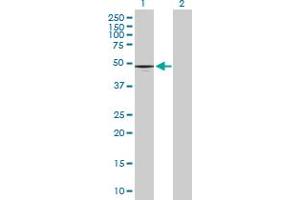 Western Blot analysis of CD177 expression in transfected 293T cell line by CD177 MaxPab polyclonal antibody. (CD177 antibody  (AA 1-437))