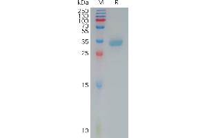 Human C(145-157) Protein, mFc Tag on SDS-PAGE under reducing condition. (Claudin 4 Protein (CLDN4) (AA 145-157) (mFc Tag))