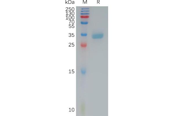 Claudin 4 Protein (CLDN4) (AA 145-157) (mFc Tag)