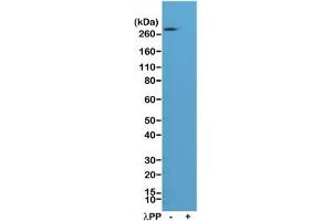 Western blot of A431 cell lysate, untreated (-) or treated (+) with Lambda Protein Phosphatase (, lambdaPP), using recombinant phospho-ACC antibody at 1:1000. (Recombinant Acetyl-CoA Carboxylase antibody  (pSer79))