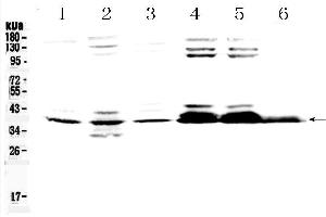 Western blot analysis of Musashi 1/Msi1 using anti- Musashi 1/Msi1 antibody . (MSI1 antibody  (N-Term))