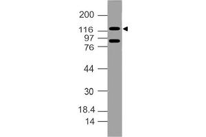 Image no. 1 for anti-Damage Specific DNA Binding Protein 1 (DDB1) (AA 300-530) antibody (ABIN5027135) (DDB1 antibody  (AA 300-530))