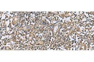 Immunohistochemistry of paraffin-embedded Human tonsil tissue using LFNG Polyclonal Antibody at dilution of 1:60(x200) (LFNG antibody)
