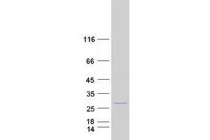 Validation with Western Blot (INF2 Protein (Myc-DYKDDDDK Tag))