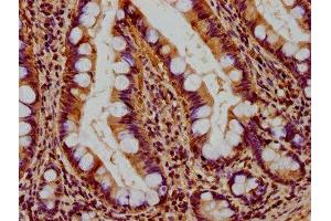 IHC image of ABIN7159941 diluted at 1:400 and staining in paraffin-embedded human small intestine tissue performed on a Leica BondTM system. (RHOT2 antibody  (AA 84-300))