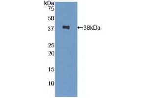 Detection of Recombinant SPINK1, Human using Polyclonal Antibody to Serine Peptidase Inhibitor Kazal Type 1 (SPINK1) (SPINK1 antibody  (AA 26-78))