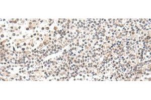 Immunohistochemistry of paraffin-embedded Human tonsil tissue using CKMT1A/CKMT1B Polyclonal Antibody at dilution of 1:55(x200) (CKMT1 antibody)