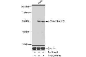 Western blot analysis of extracts of HeLa cells, using Phospho-Vimentin-S39 antibody (ABIN7271327) at 1:1000 dilution. (Vimentin antibody  (pSer39))