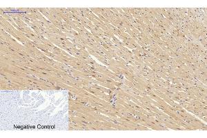 Immunohistochemical analysis of paraffin-embedded rat heart tissue. (SYN1 antibody)