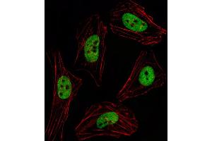 Fluorescent image of Hela cell stained with PITX2 Antibody . (PITX2 antibody  (AA 122-151))