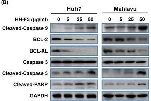 Western Blotting (WB) image for anti-B-Cell CLL/lymphoma 2 (BCL2) (N-Term) antibody (ABIN2857047)