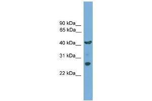 WB Suggested Anti-TMEM176A Antibody Titration:  0. (TMEM176A antibody  (N-Term))