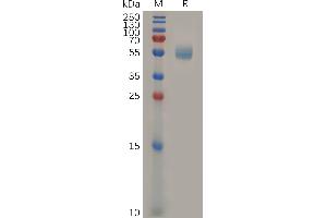 Mouse GITR Protein, hFc Tag on SDS-PAGE under reducing condition. (TNFRSF18 Protein (AA 22-153) (Fc Tag))