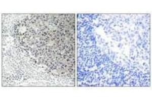 Immunohistochemistry analysis of paraffin-embedded human tonsil tissue using Collagen IX α3 antibody. (COL9A3 antibody)