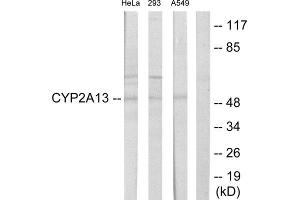 Western Blotting (WB) image for anti-Cytochrome P450, Family 2, Subfamily A, Polypeptide 13 (CYP2A13) (Internal Region) antibody (ABIN1850349) (CYP2A13 antibody  (Internal Region))