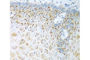 Immunohistochemistry of paraffin-embedded Human esophagus using FDXR Polyclonal Antibody at dilution of 1:100 (40x lens). (Ferredoxin Reductase antibody)