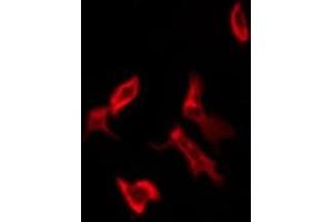 ABIN6276248 staining Hela by IF/ICC. (Olfactory Receptor 11H1/11H2/11H12 antibody)